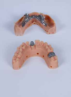 牙科铸造树脂